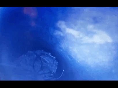 Nest removal with camera